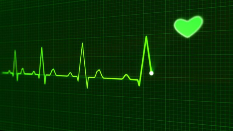 Jak zjistit klidové a zátěžové EKG?