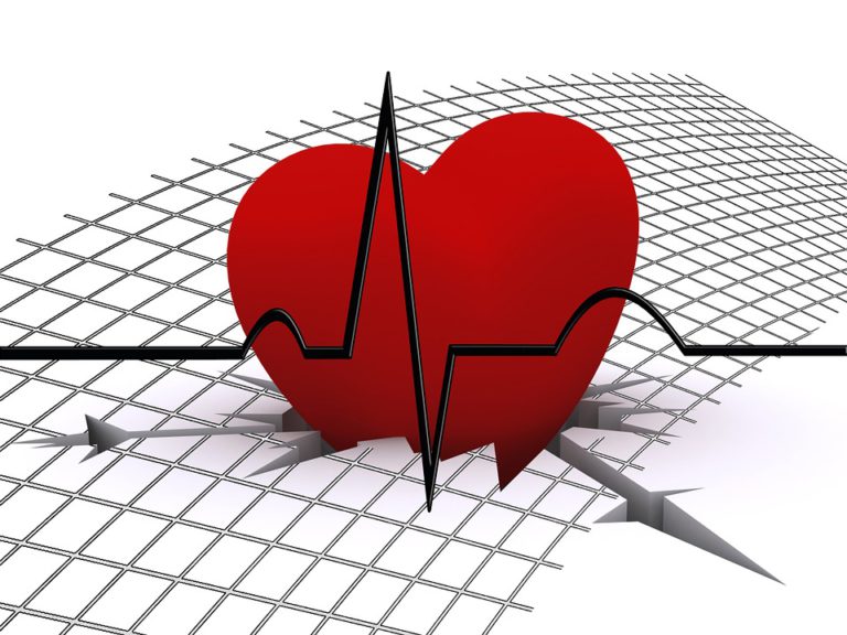 Přístroje EKG jsou dnes na daleko vyšší úrovni