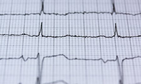 měření ekg