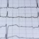 měření ekg