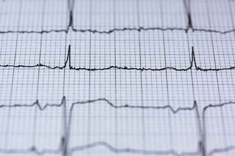 Jak vypadají novodobé EKG přístroje?